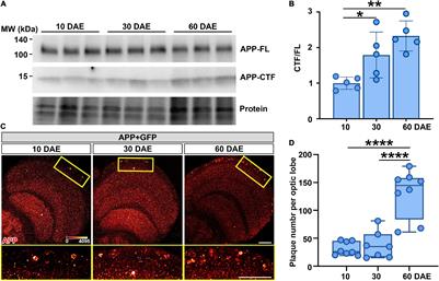 Human Nmnat1 Promotes Autophagic Clearance of Amyloid Plaques in a Drosophila Model of Alzheimer’s Disease